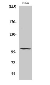 PMS2 rabbit pAb Antibody