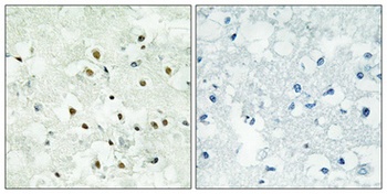 PMS2 rabbit pAb Antibody