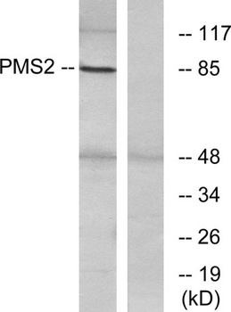 PMS2 rabbit pAb Antibody