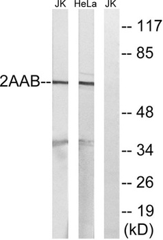PP2A-Aβ rabbit pAb Antibody