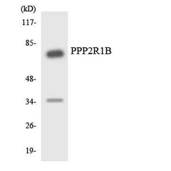 PP2A-Aβ rabbit pAb Antibody