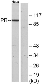 PR rabbit pAb Antibody