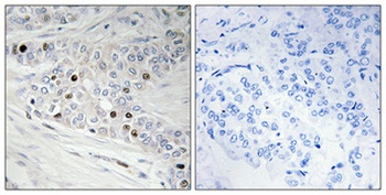 PREP-2 rabbit pAb Antibody
