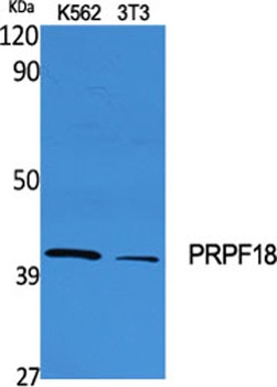 PRPF18 rabbit pAb Antibody