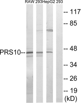 PSMC6 rabbit pAb Antibody