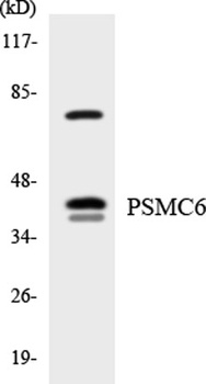 PSMC6 rabbit pAb Antibody