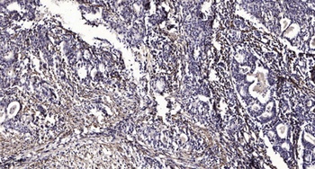 PSMC6 rabbit pAb Antibody