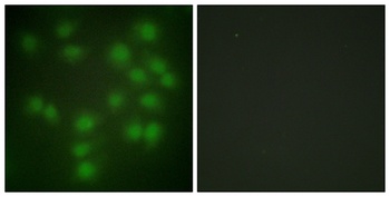 PTTG1/2/3 rabbit pAb Antibody
