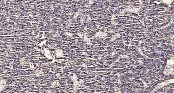 PTTG1/2/3 rabbit pAb Antibody