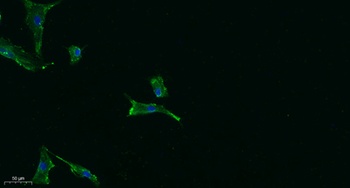 PUMA rabbit pAb Antibody