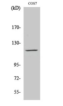 PYK2 rabbit pAb Antibody