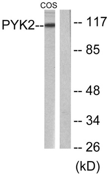 PYK2 rabbit pAb Antibody