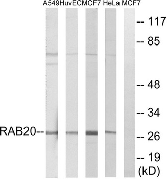 Rab 20 rabbit pAb Antibody