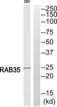 Rab 35 rabbit pAb Antibody