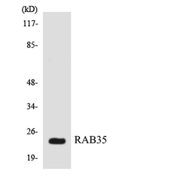Rab 35 rabbit pAb Antibody