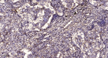 Rab 35 rabbit pAb Antibody