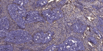 Rab 7L1 rabbit pAb Antibody