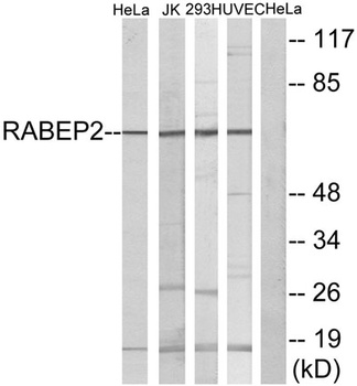 Rabaptin-5β rabbit pAb Antibody