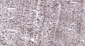 Rac GAP1 rabbit pAb Antibody