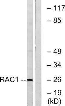 Rac1/2/3/CDC42 rabbit pAb Antibody