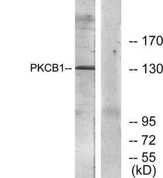 RACK7 rabbit pAb Antibody