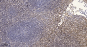 RACK7 rabbit pAb Antibody