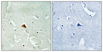 Rad23B rabbit pAb Antibody