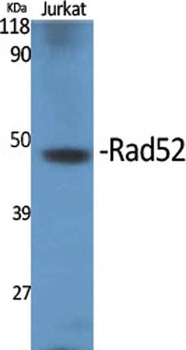 Rad52 rabbit pAb Antibody