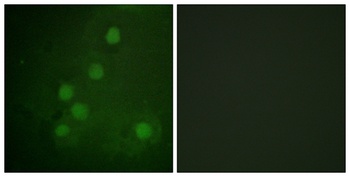 Rad52 rabbit pAb Antibody