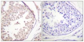 Rad52 rabbit pAb Antibody