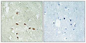Rag A/B rabbit pAb Antibody