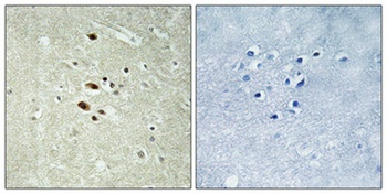 Rag A/B rabbit pAb Antibody