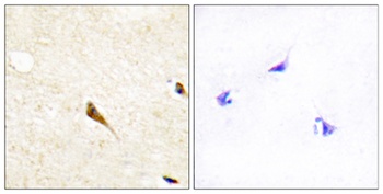 RAGE rabbit pAb Antibody