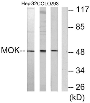 RAGE rabbit pAb Antibody