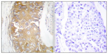 Rak rabbit pAb Antibody