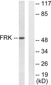 Rak rabbit pAb Antibody