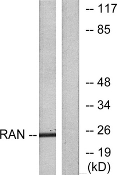 Ran rabbit pAb Antibody