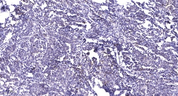 Rap 2C rabbit pAb Antibody