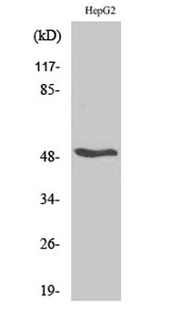 RARβ rabbit pAb Antibody