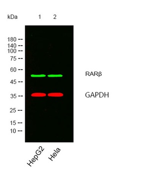 RARβ rabbit pAb Antibody