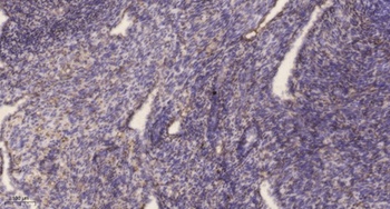 RCL rabbit pAb Antibody