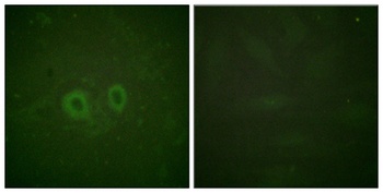 Ret rabbit pAb Antibody
