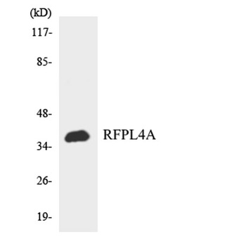 RFPL4A rabbit pAb Antibody