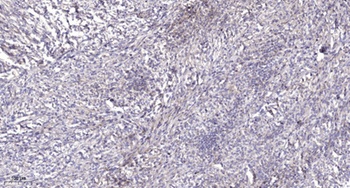 RFPL4A rabbit pAb Antibody
