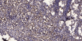 Rho D rabbit pAb Antibody