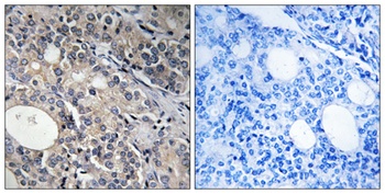 Ribosomal Protein L17 rabbit pAb Antibody