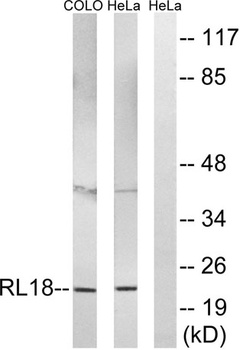Ribosomal Protein L18 rabbit pAb Antibody