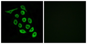 Ribosomal Protein S12 rabbit pAb Antibody