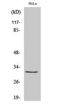 Ribosomal Protein S2 rabbit pAb Antibody