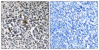 Ribosomal Protein S3 rabbit pAb Antibody
